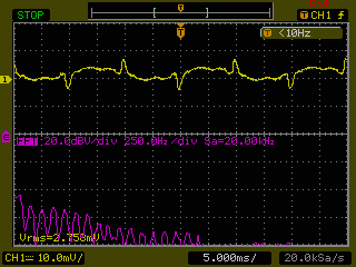 15V_SMPS_NL_100mA_div